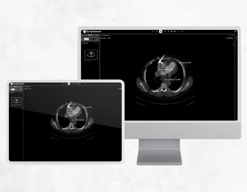 Cardiology PACS platform showing heart MRI scans on PC monitor and tablet for precise diagnosis.