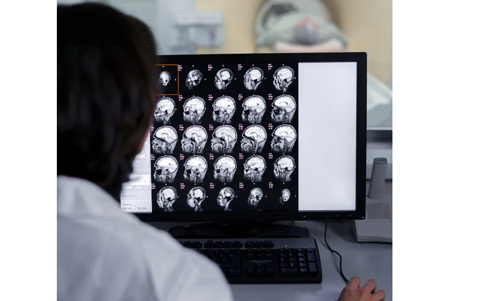 Doctor reviewing head scan reports on computer screen in clinical setting for accurate diagnosis.