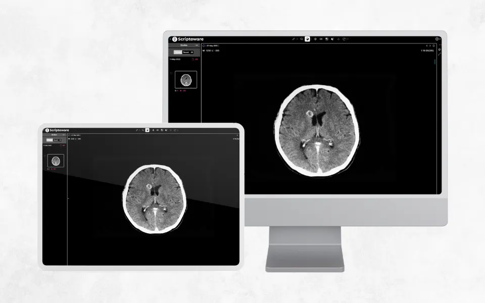DICOM Image Viewer showing MRI scans on PC and tablet, enabling seamless, scalable medical imaging access.
