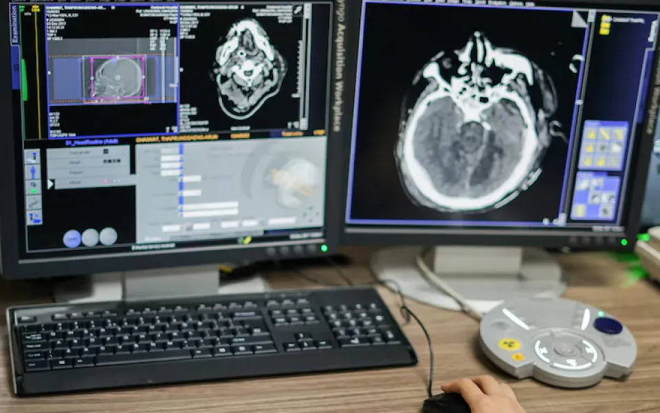 Close-up of a PC screen displaying DICOM images