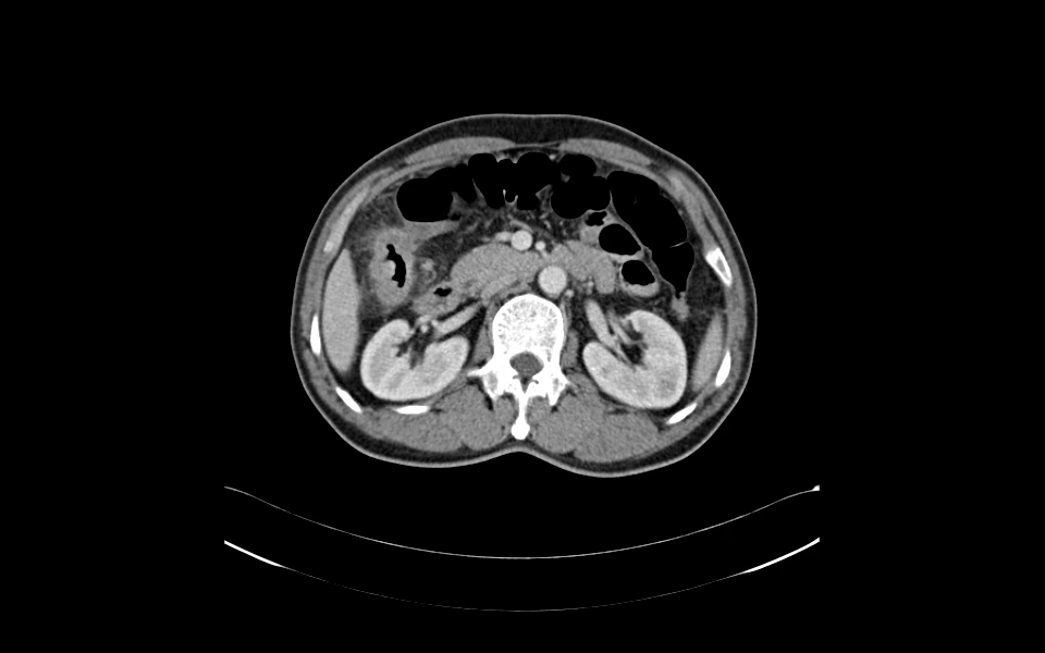 Abdominal imaging for diagnosis shown via Scriptoware’s viewer