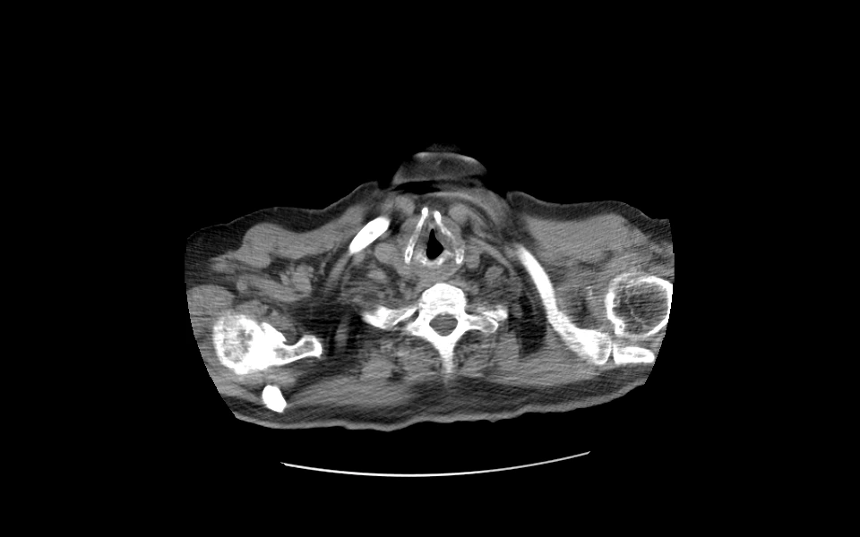 Scriptoware displaying belly scan for clinical analysis