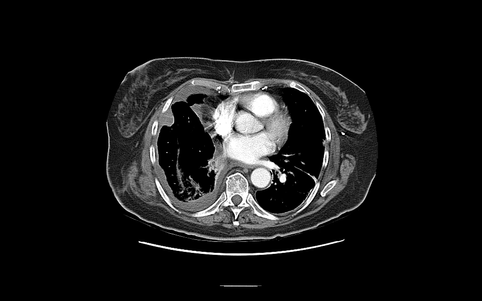 Detailed stomach scan image using Scriptoware DICOM solution