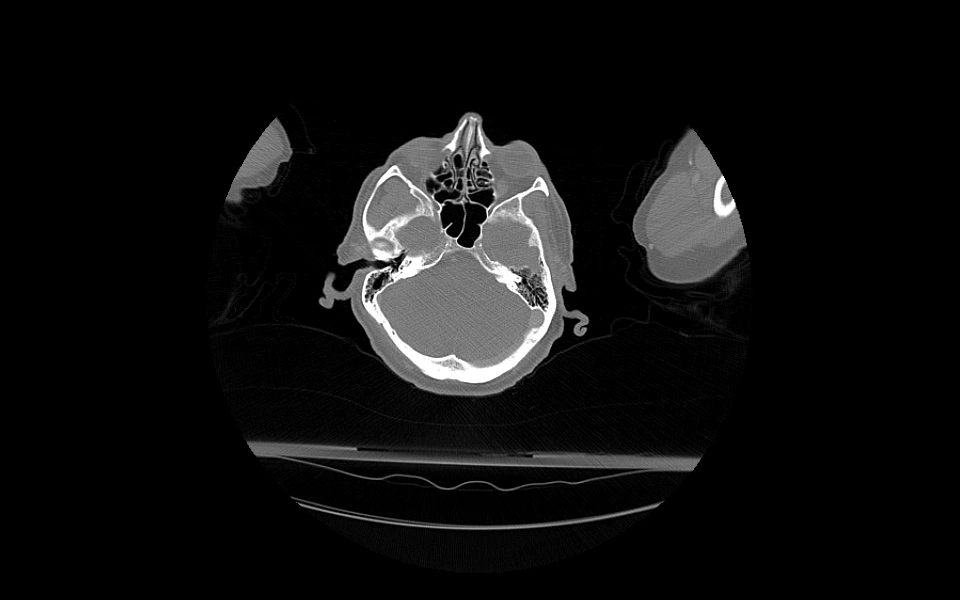 Cross-sectional abdominal scan rendered with Scriptoware platform