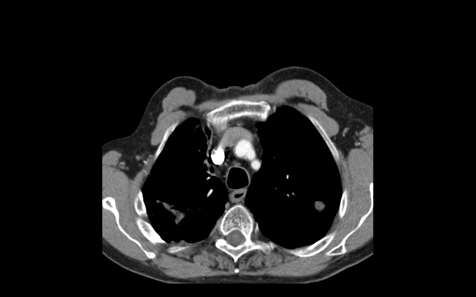 Belly CT scan image shown using Scriptoware’s DICOM viewer