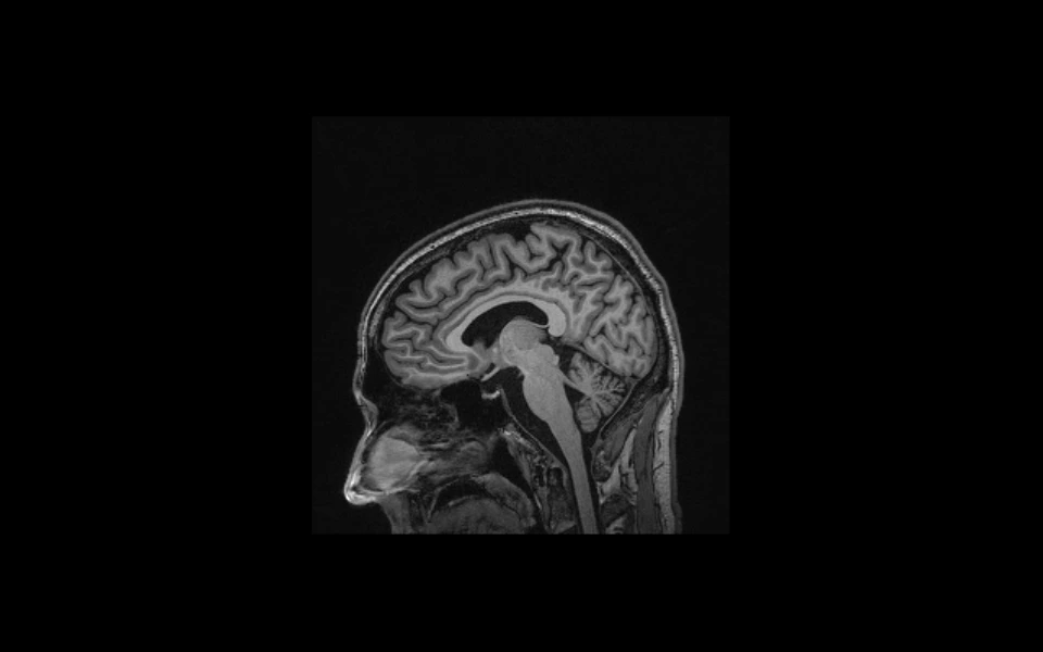 Internal stomach scan image visualized through Scriptoware platform