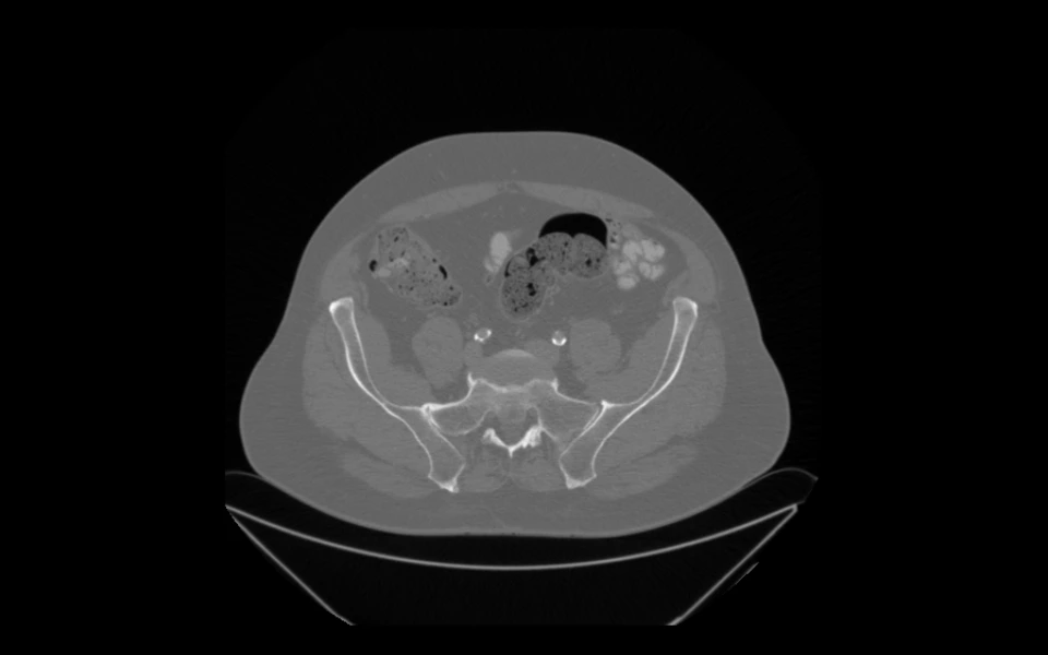 Abdominal scan image displayed using Scriptoware's DICOM viewer