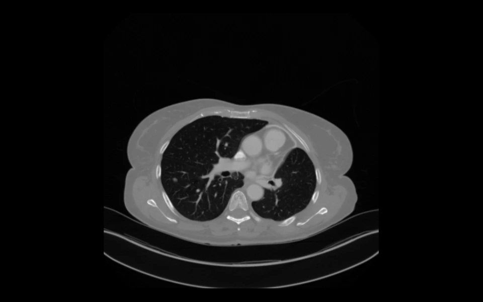 Brain imaging slice viewed with Scriptoware’s DICOM tool