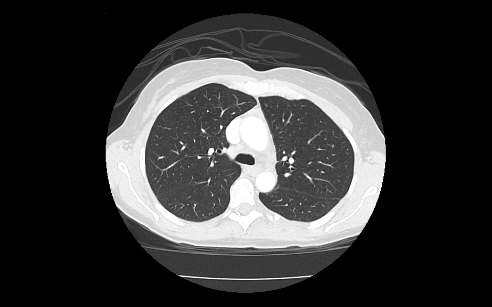 Brain CT scan image viewed on Scriptoware’s diagnostic platform