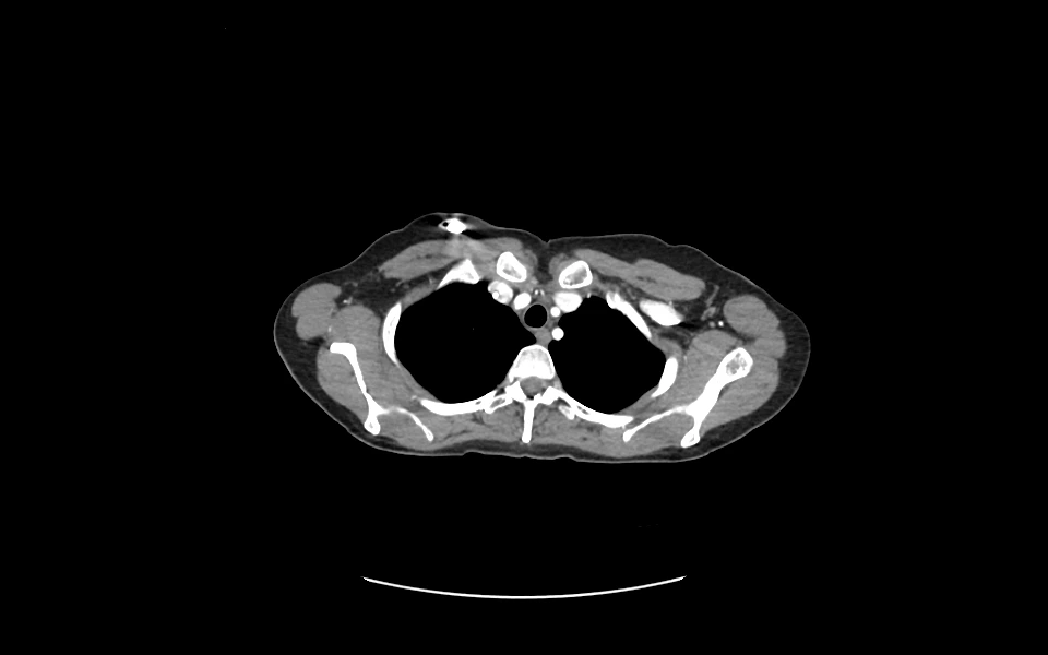 Head MRI scan with detailed brain structure using Scriptoware viewer