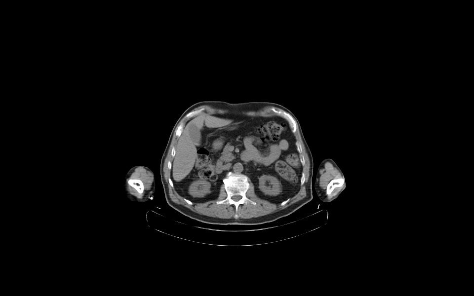 Real-time abdominal scan image on Scriptoware’s DICOM tool