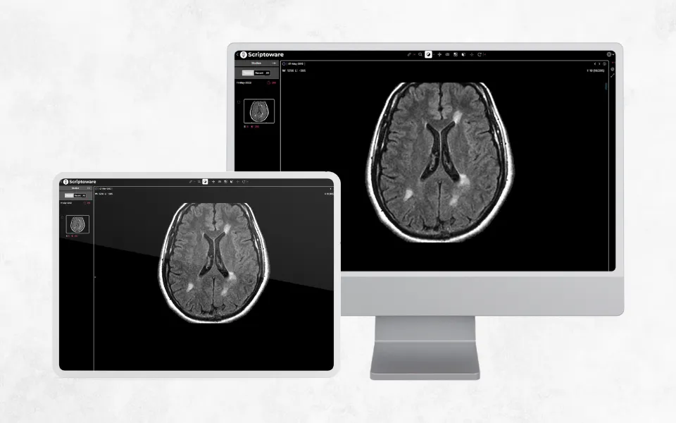 Young doctor reviewing head scans on PC and live MRI reports on tablet, showcasing tech-driven imaging.