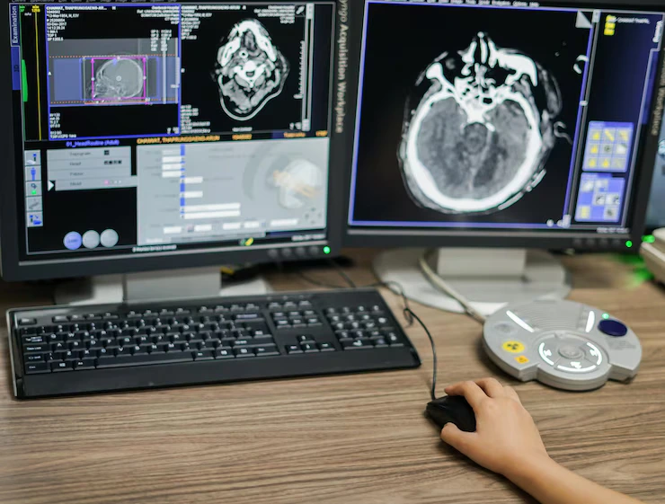 Close-up of a doctor's hand scrolling with a mouse on a screen displaying a head scan using Scriptoware's imaging viewer