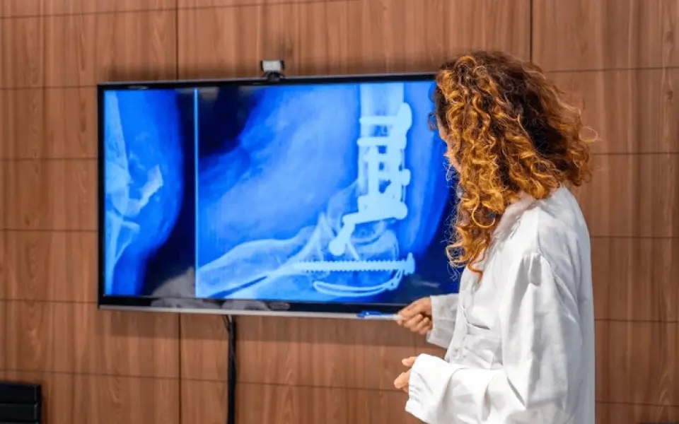 Orthopedic doctor reviewing a patient's bone scan with surgically attached joint on a medical imaging screen using Scriptoware platform