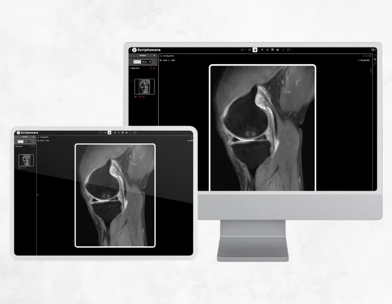 Orthopedic PACS platform showing MRI scans on PC monitor and tablet for precise diagnosis.