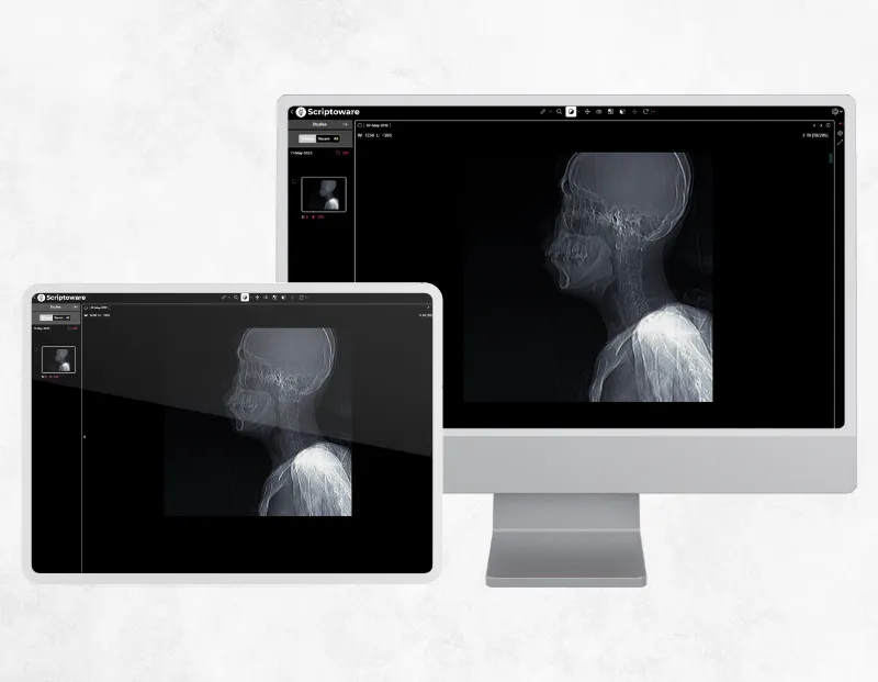 Radiology PACS platform showing MRI scans on PC and tablet for accurate diagnosis and collaboration.