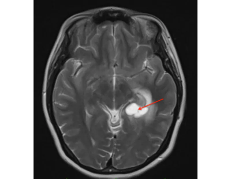 Oncology PACS platform showing tumor scans on PC and tablet for accurate diagnosis and collaborative care.